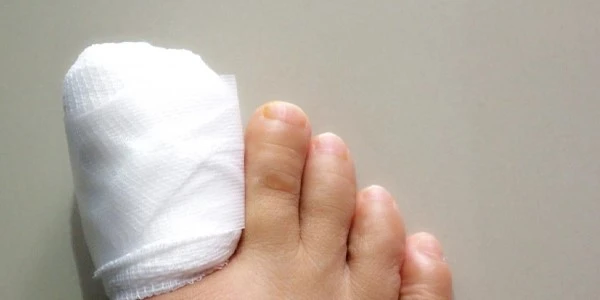 Big-toe-nail-removal-surgery