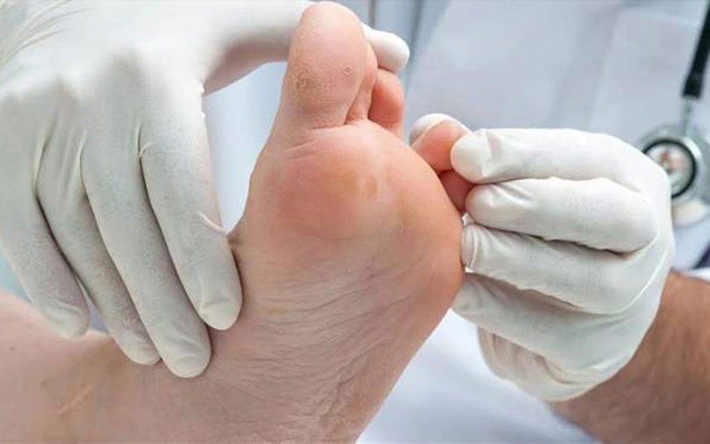 Diabetic-toe-infection-treatment