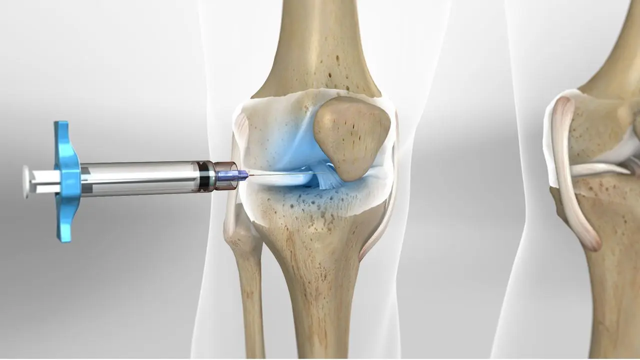 Knee-arthritis-ampoule