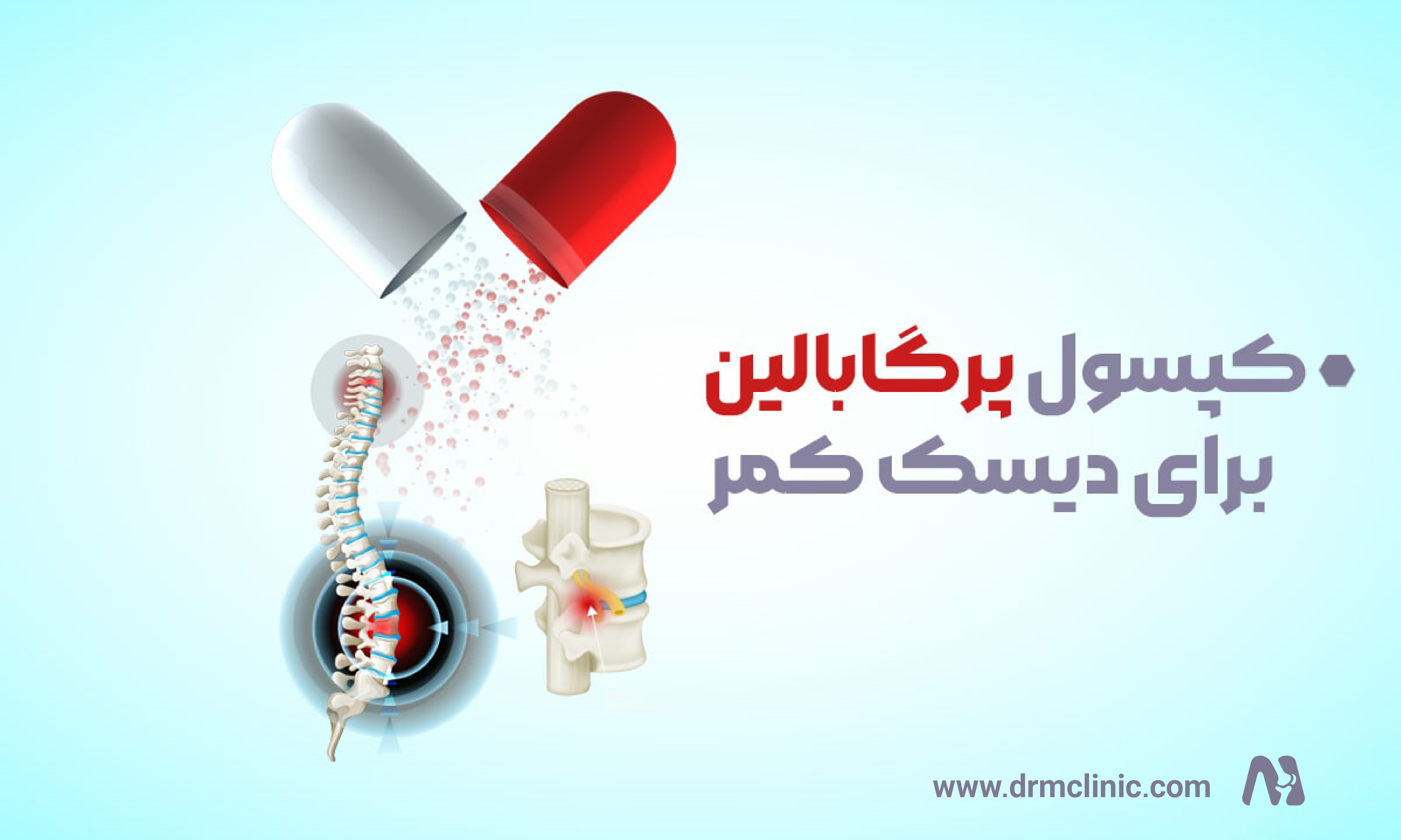 کپسول پرگابالين برای ديسک کمر