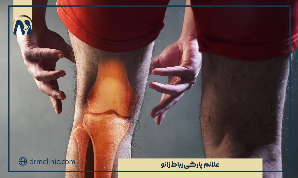 علائم پارگی رباط زانو