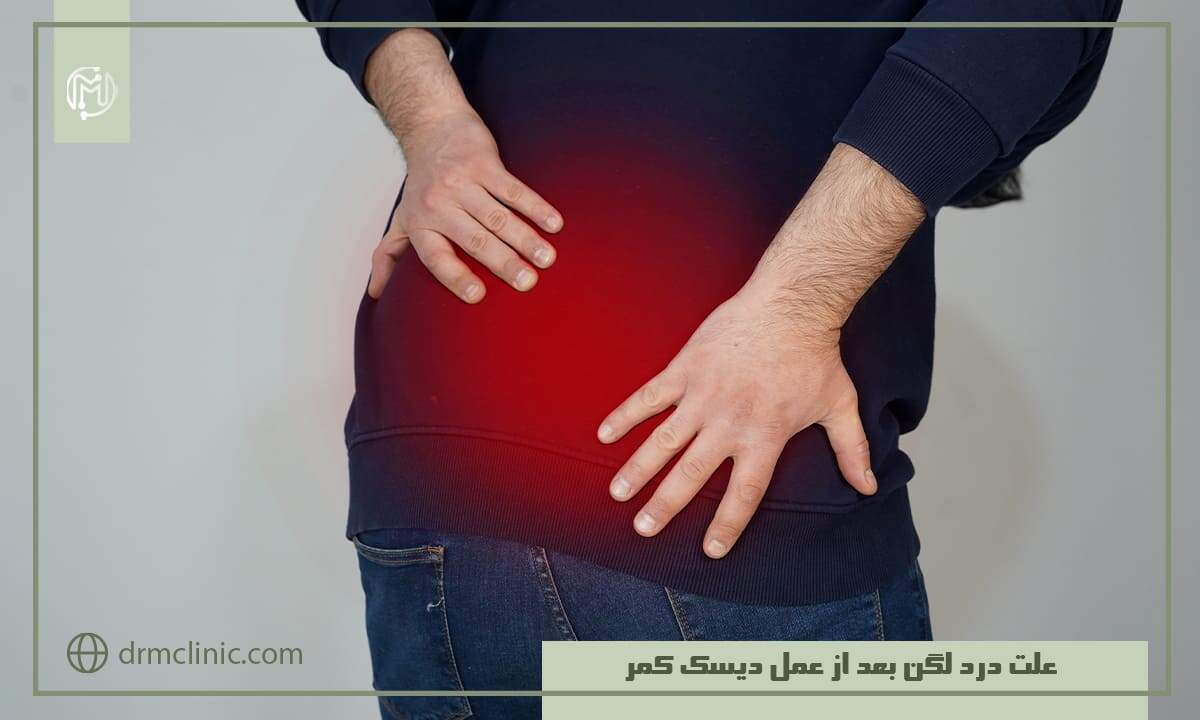 علت درد لگن بعد از عمل دیسک کمر
