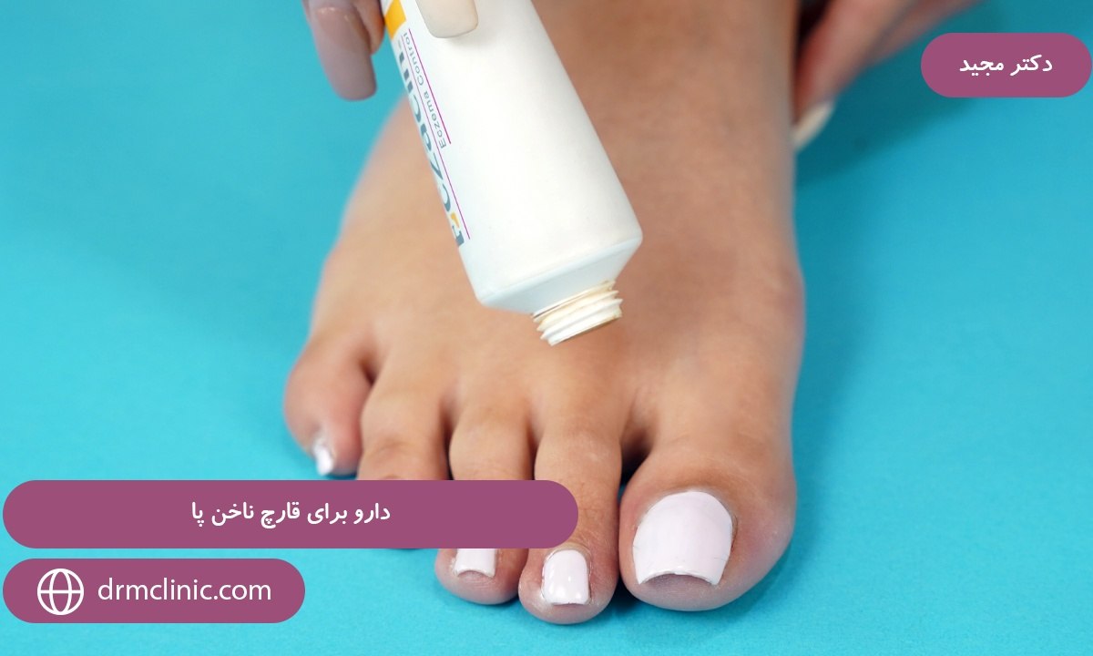 دارو برای قارچ ناخن پا